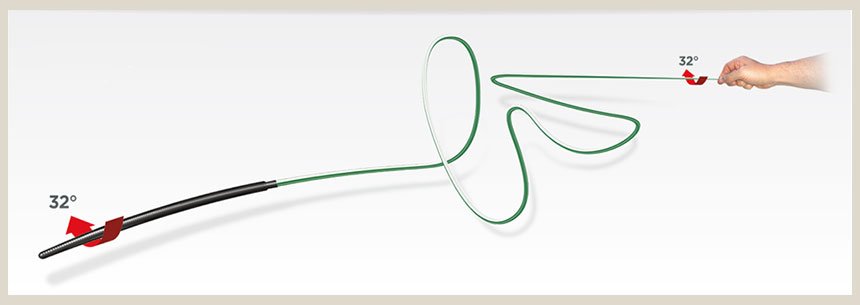 ASAHI Fielder XT Coronary Guidewire